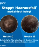REGAINE Männer Schaum 50 mg/g bei anlagebedingtem Haarausfall